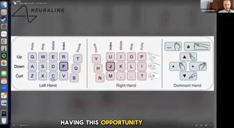 Neuralink: Paciente bate recorde de 141 ppm usando a mente