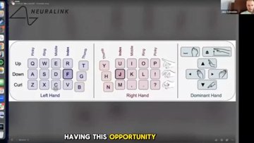 Neuralink-patiënt typt 141 WPM met zijn gedachten
