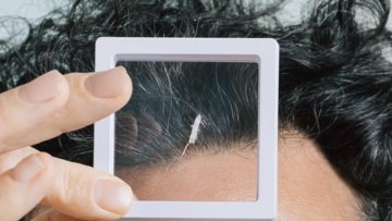 Robeauté's rijstkorrelgrote robot navigeert door hersenen tegen tumoren