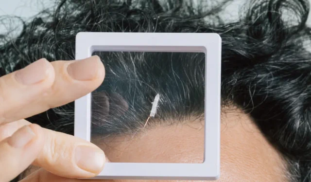 Robeauté: Microrrobô navega no cérebro para combater tumores