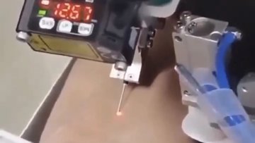 Robot trekt bloed met 94,3% succespercentage